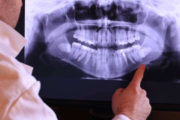 Best Emergency Dental Services for Seniors in Croom, MD